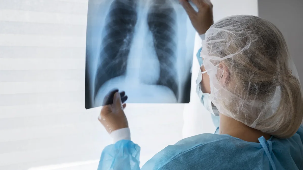 Tuberculose : sécher dans l’air abîme l’ADN du bacille et aide les souches résistantes