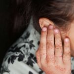 Comment reconna&icirc;tre une surinfection de l&rsquo;oreille ?