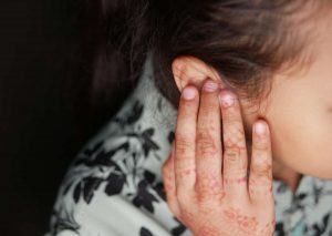 Comment reconna&icirc;tre une surinfection de l&rsquo;oreille ?